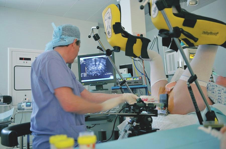 Tratamento de Próstata